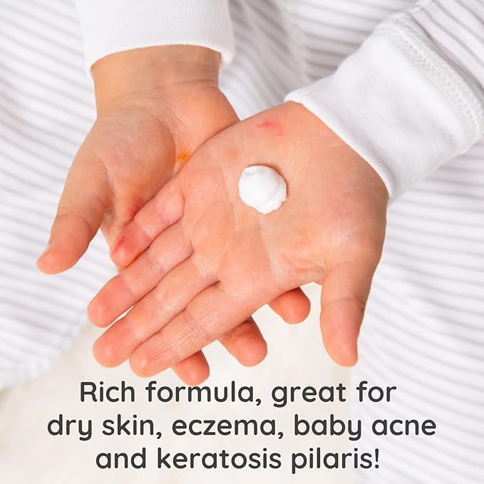 Bubbsi Whipped Coconut Oil Baby Lotion for Eczema, Dry Skin, Baby Acne, KP | Organic Coconut Oil, Shea Butter, Vitamin E | Light, Natural Scent | EU Compliant, Vegan (Refill Pouch, 32oz)
